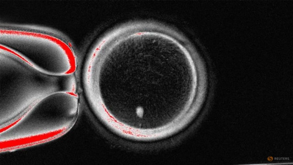 Scientists create human eggs using skin cells